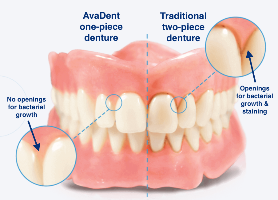 comparison of a bacteria free AvaDent Denture and a bacteria riddled traditional denture