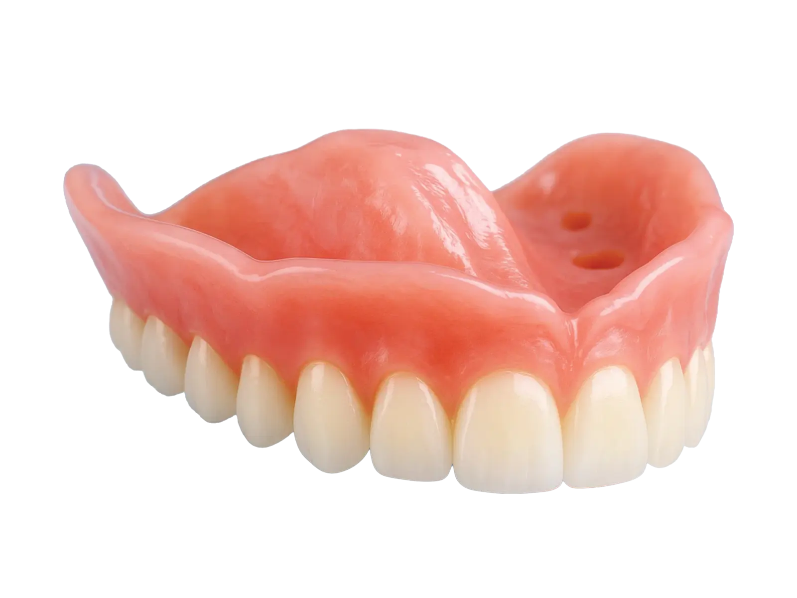 AvaDent implant-secured overdenture