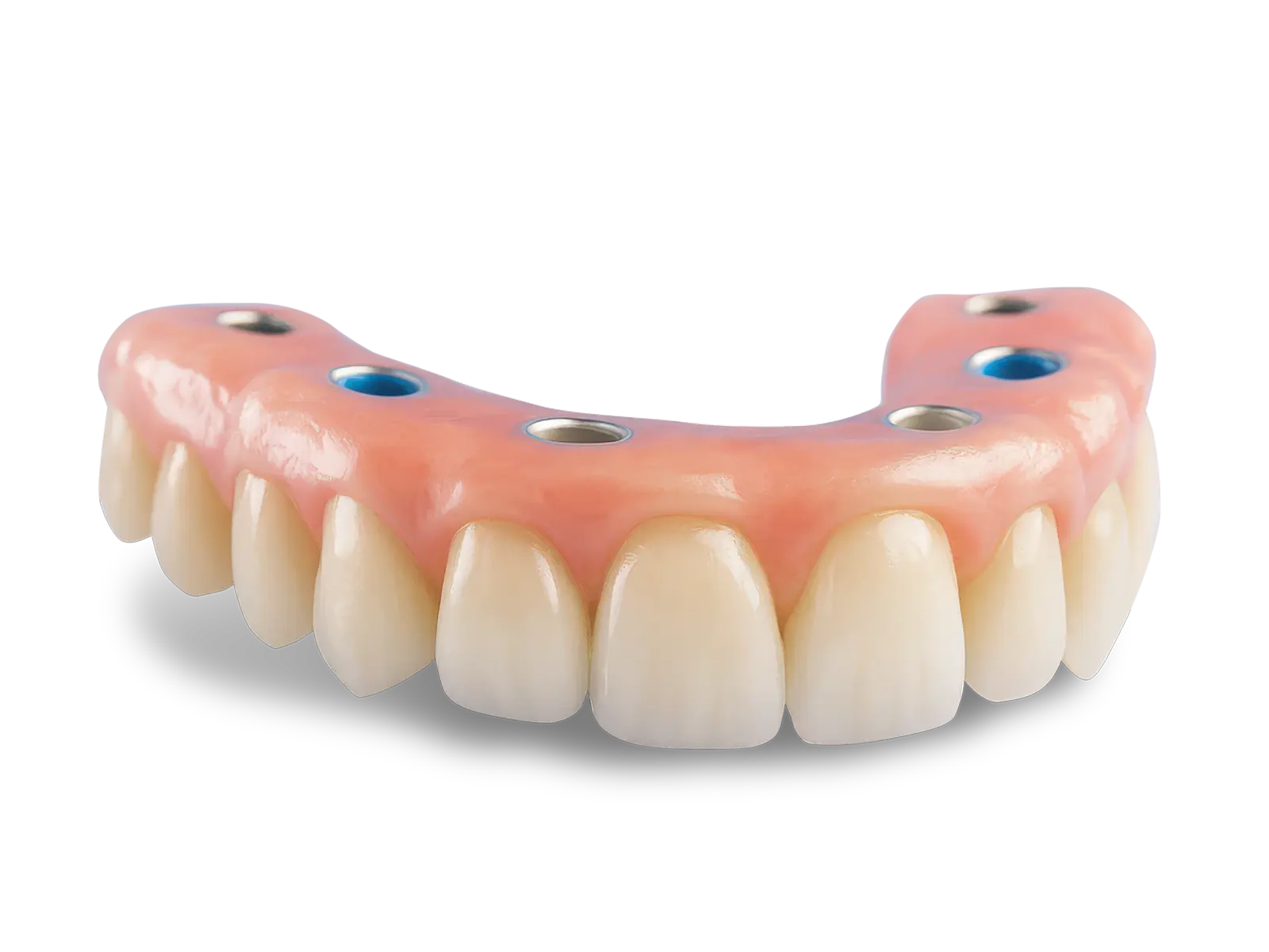 AvaMax LOCATOR FIXED implant-supported denture