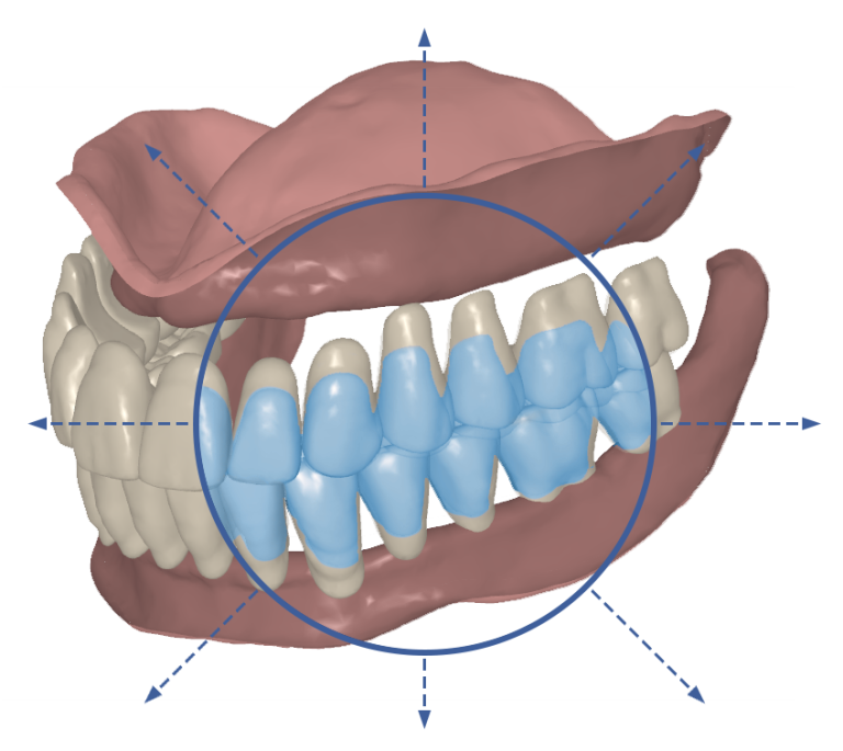 Signature Teeth scaling a group of teeth in the AvaDent design software
