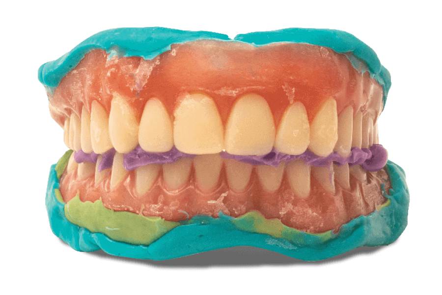 Reference Denture