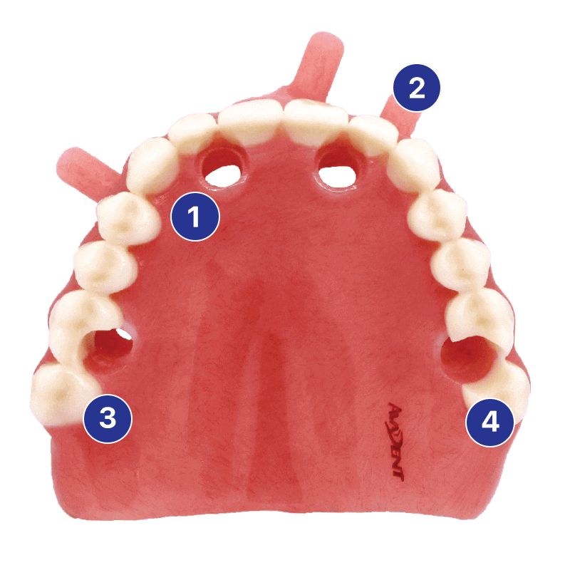 SurgiDenture™