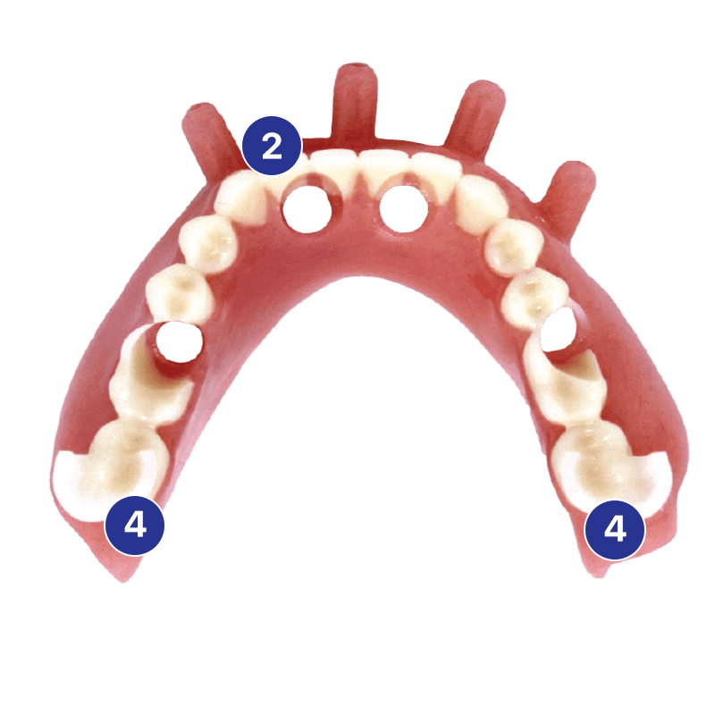 SurgiDenture™