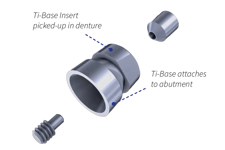 Smart Denture Conversion