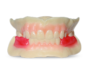 Wagner Try-In Denture