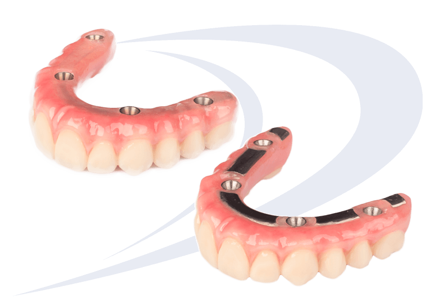Solid Bar Hybrid Dentures