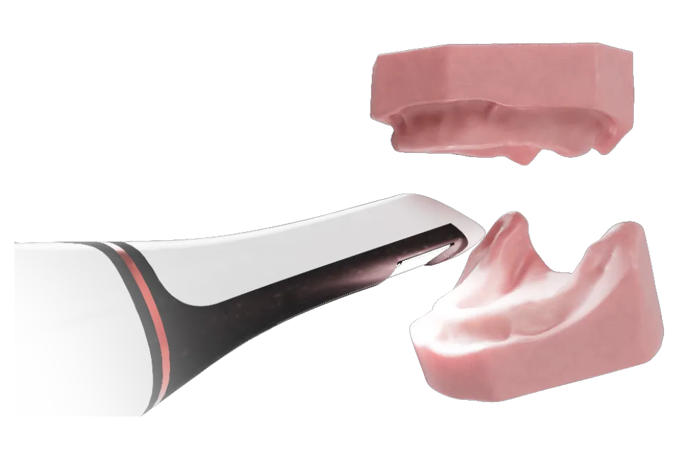Intraoral Scan