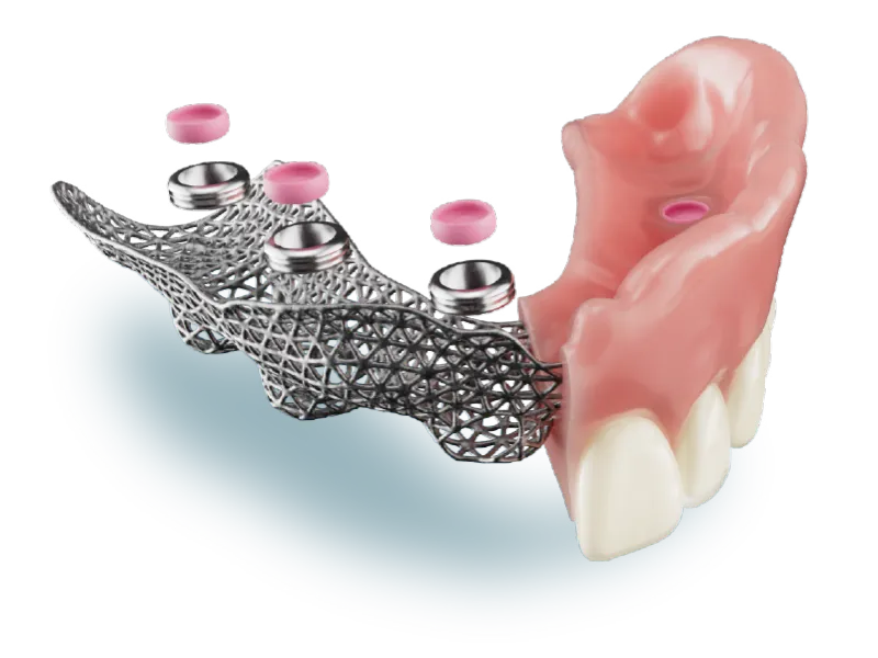 Hybrid