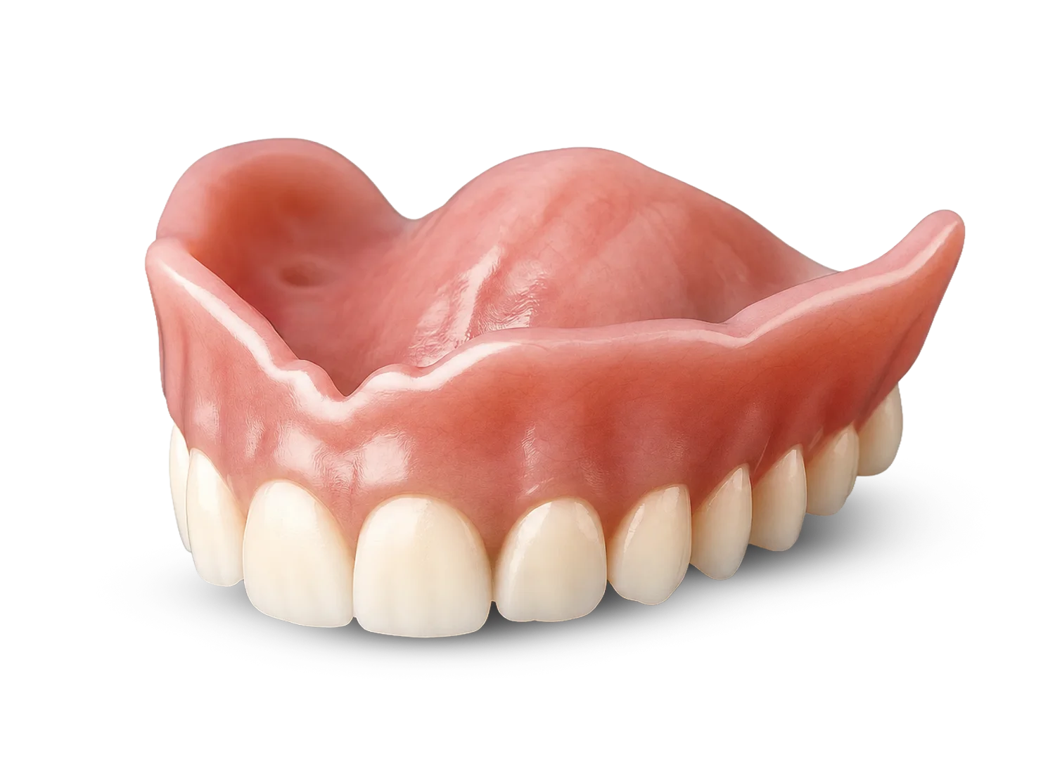 Overdenture