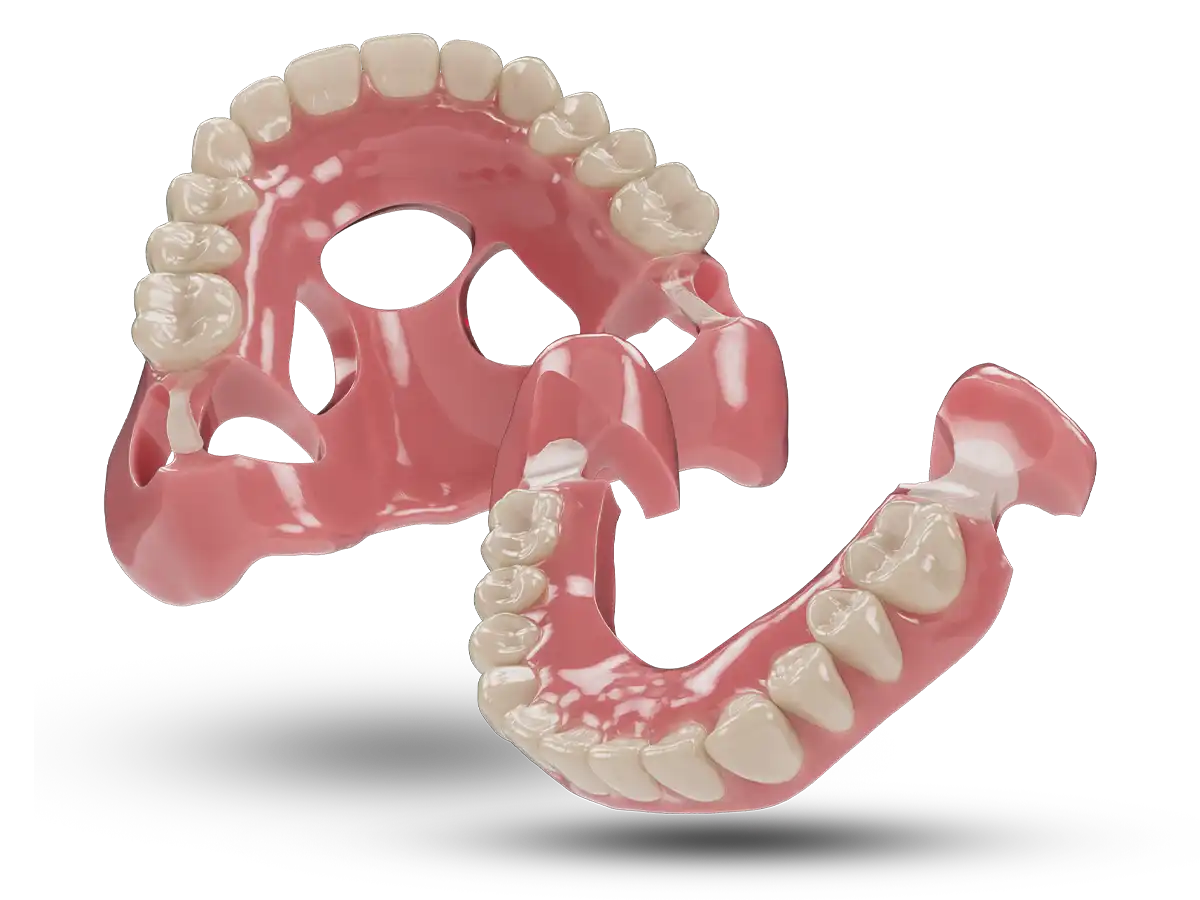 AvaDent conversion denture