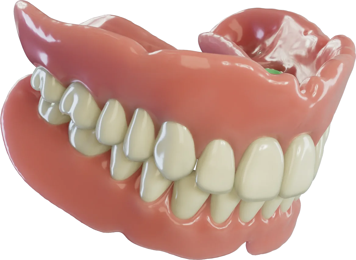 AvaMax upper and lower overdentures